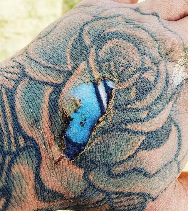 Quemadura en la epidermis de la mano que deja expuestos los brillantes colores de un tatuaje atrapado en la dermis