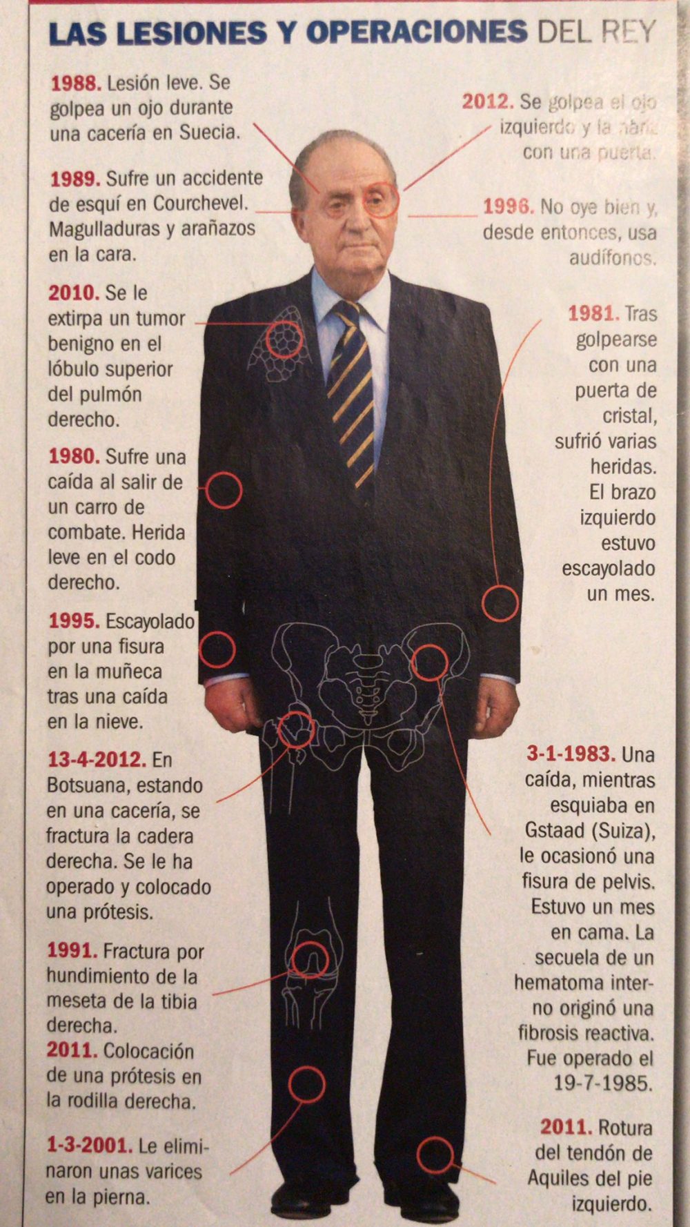 Espero que esto no signifique el fin de mi género periodístico español favorito: las infografías de las lesiones de Juan Carlos.