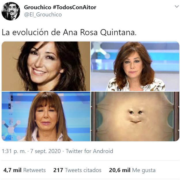 Parece que Ana Rosa Quintana ha ido al mismo cirujano que Kiko Matamoros
