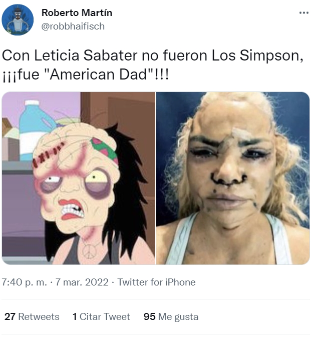 Leticia Sabater se ha operado la cara