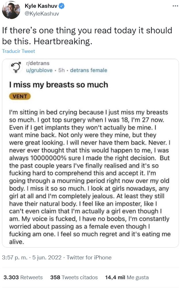 Lo que ocurre cuando te quitas las tеtas por moda, que terminas arrepintiéndote.