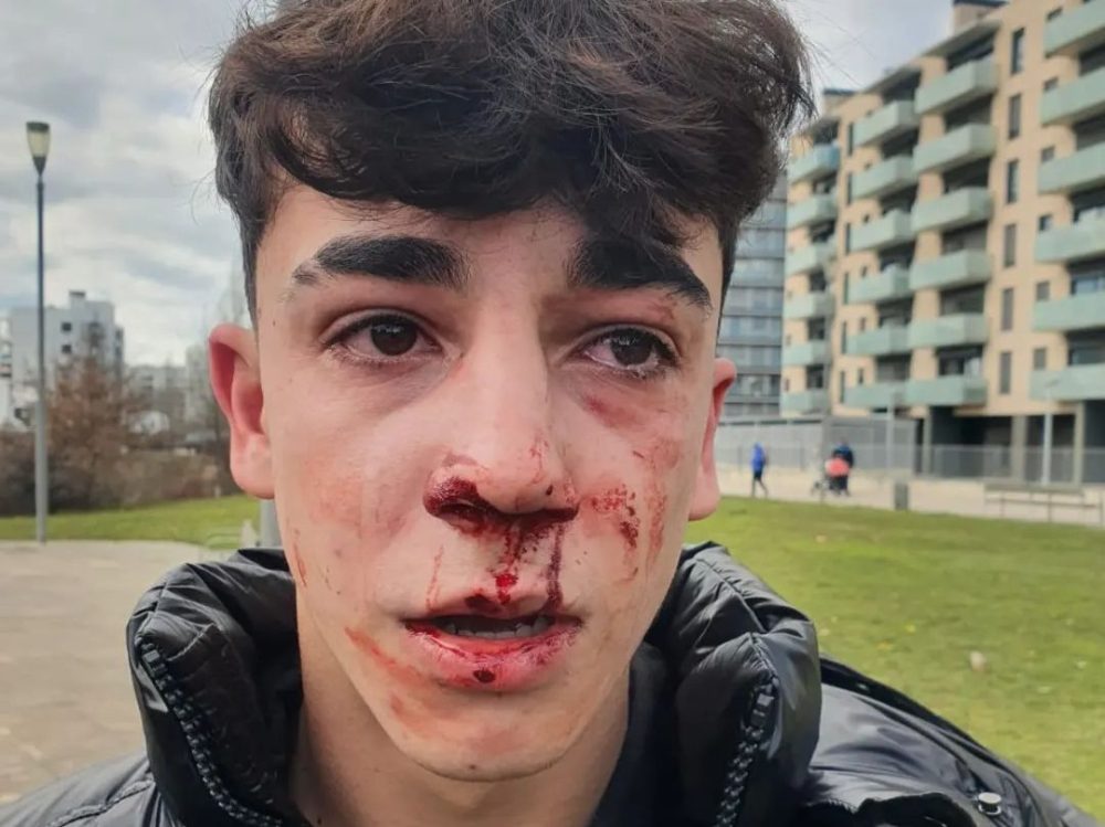 Denuncian una agresión policial a un menor que iba en patinete por la acera en Vitoria