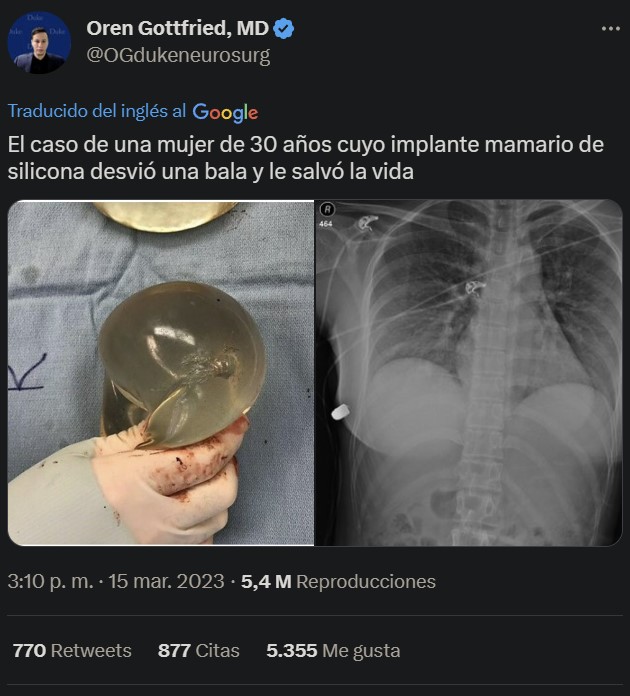 Lo que no te mаta te hace más fuerte