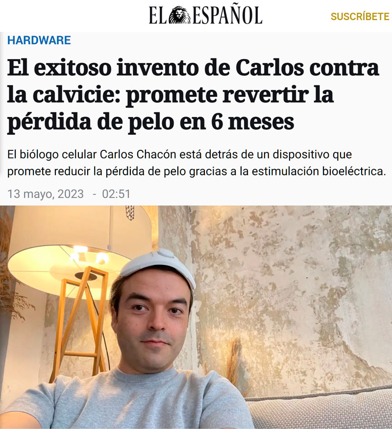 Hay esperanza para la calvocracia: un artilugio atroz que proyecta rayos cósmicos en tu cartón "promete reactivar las células madre del cuero cabelludo"