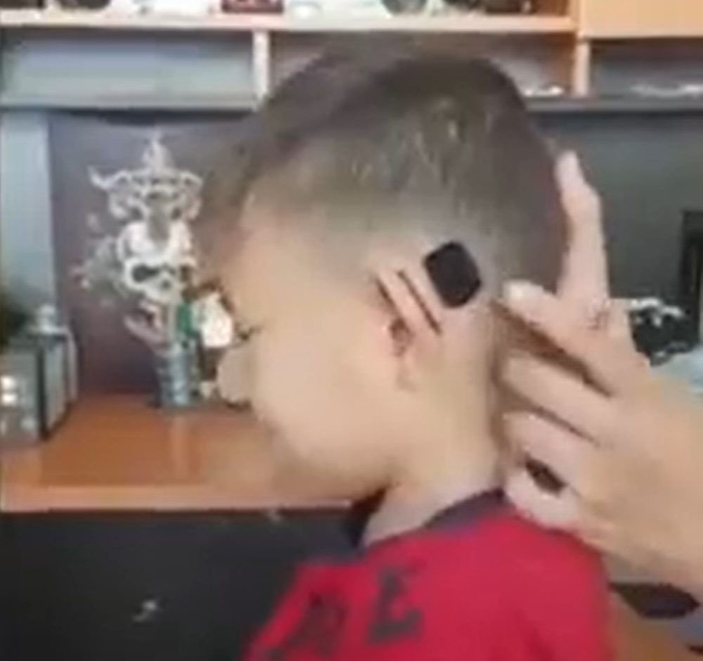 Técnicas de pobreza que te ahorran miles de euros en caras cirugías