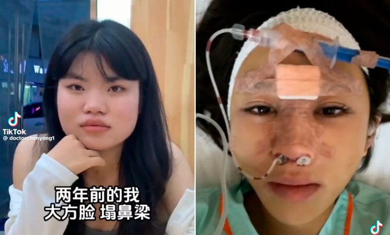 Si a alguno de vosotros os sigue la Interpol, quizás os interese conseguir el teléfono de este cirujano plástico...