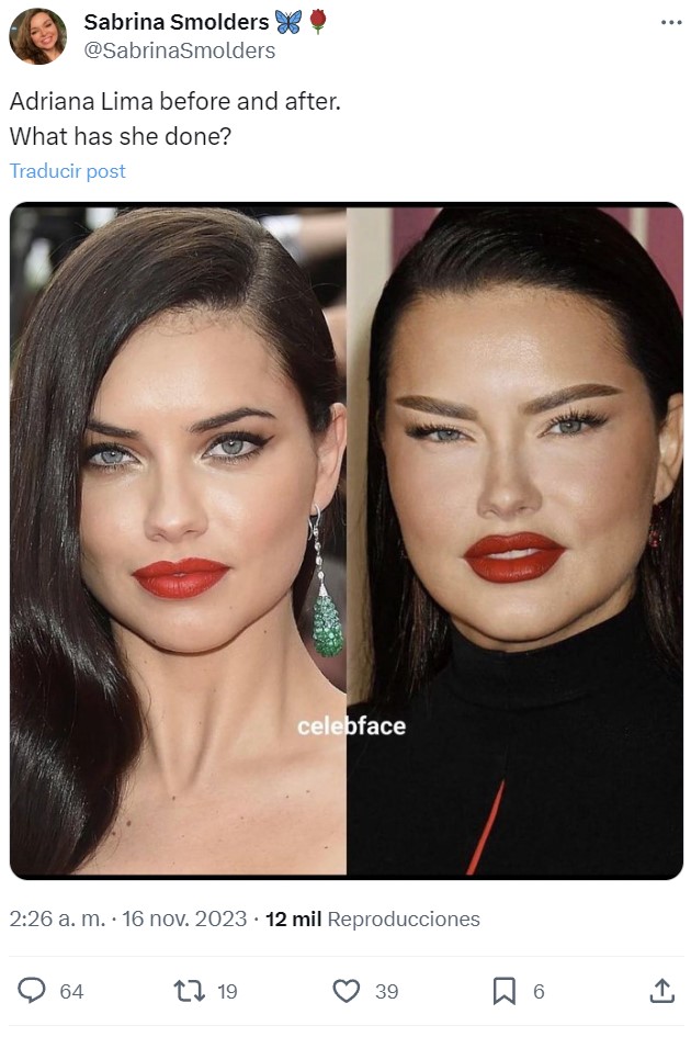 ¿Qué le pasa a Adriana Lima en la cara?
