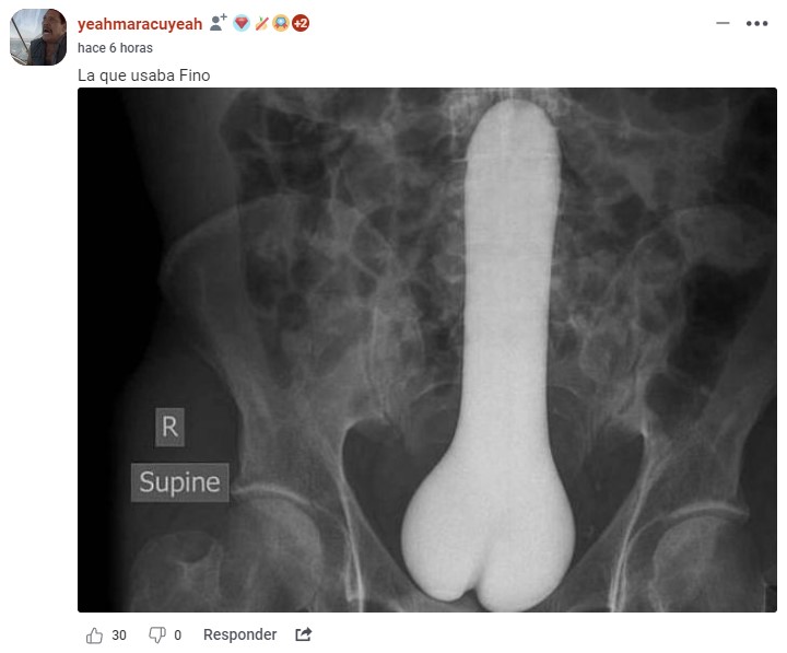 Fotos para usar cuando queráis faltar al trabajo