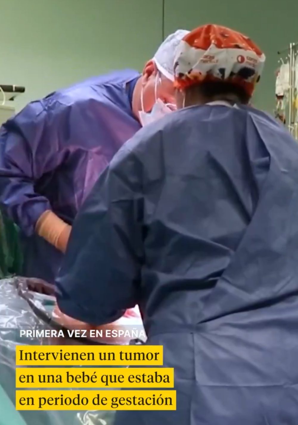 Intervienen por primera vez en España un tumor en una bebé que estaba en periodo de gestación.