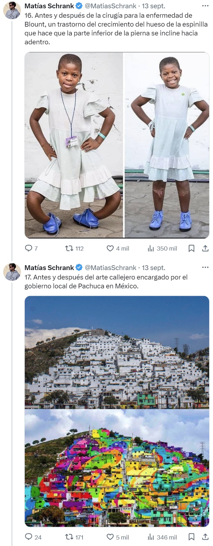 ANTES vs DESPUÉS.