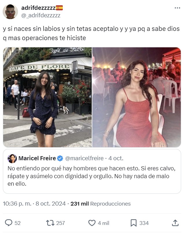 "No entiendo por qué hay hombres que hacen esto. Si eres calvo, rápate y asúmelo con dignidad y orgullo. No hay nada de malo en ello".