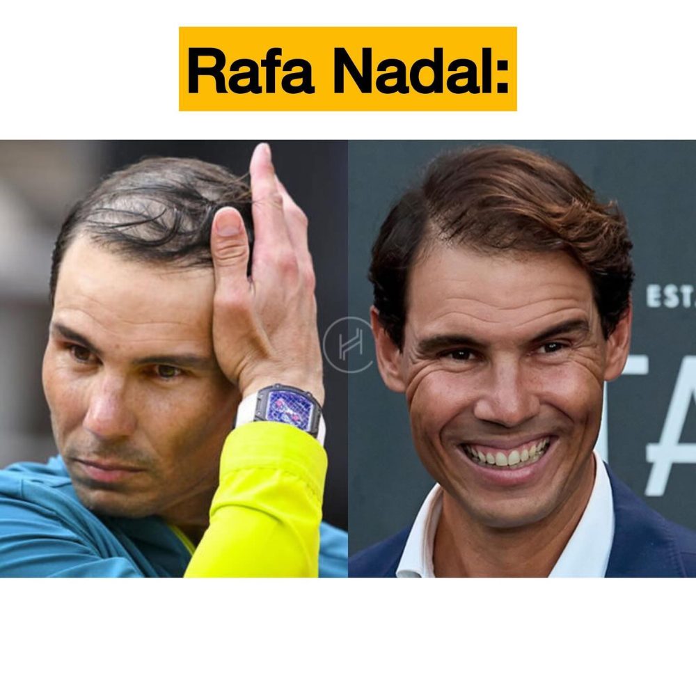 Las mayores remontadas hechas por famosos.