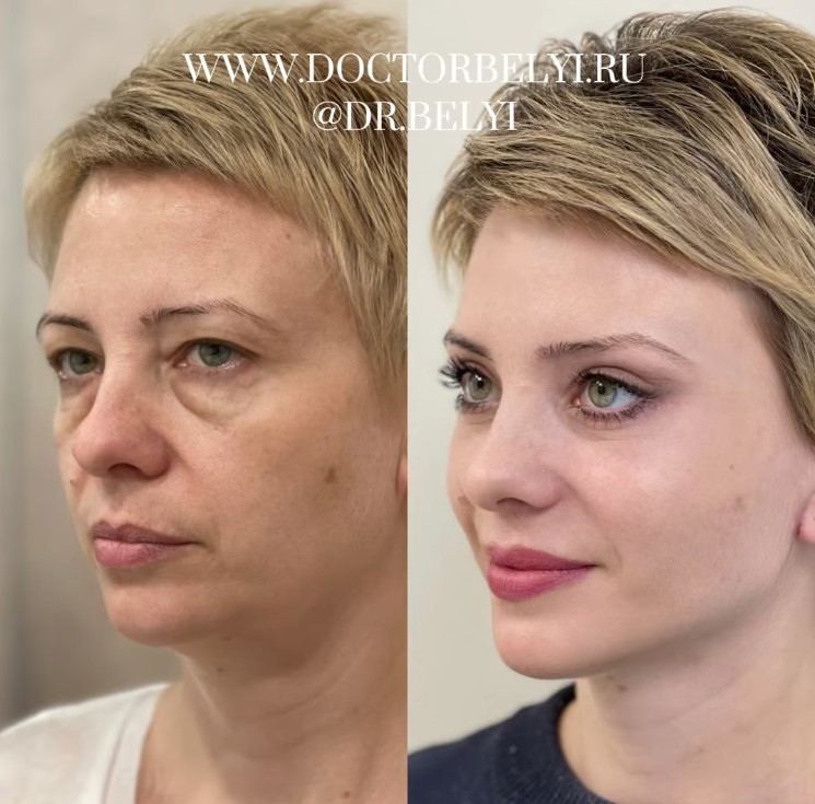 Otra vez... emosido engañado.