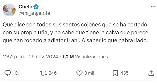 ¿Qué le ha pasado a Guardiola en la cara?