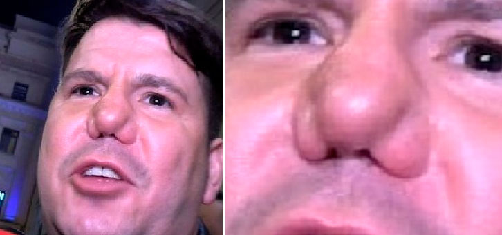 Lucas sigue insistiendo en que a su nariz no le pasa nada: "Soy feo".
