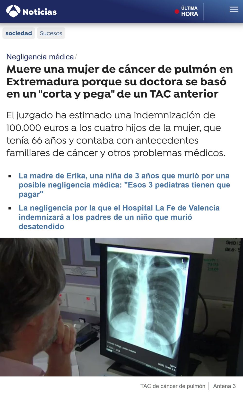 Muere de Cáncer de pulmón después de que médico usara un copia-pega de un TAC anterior.