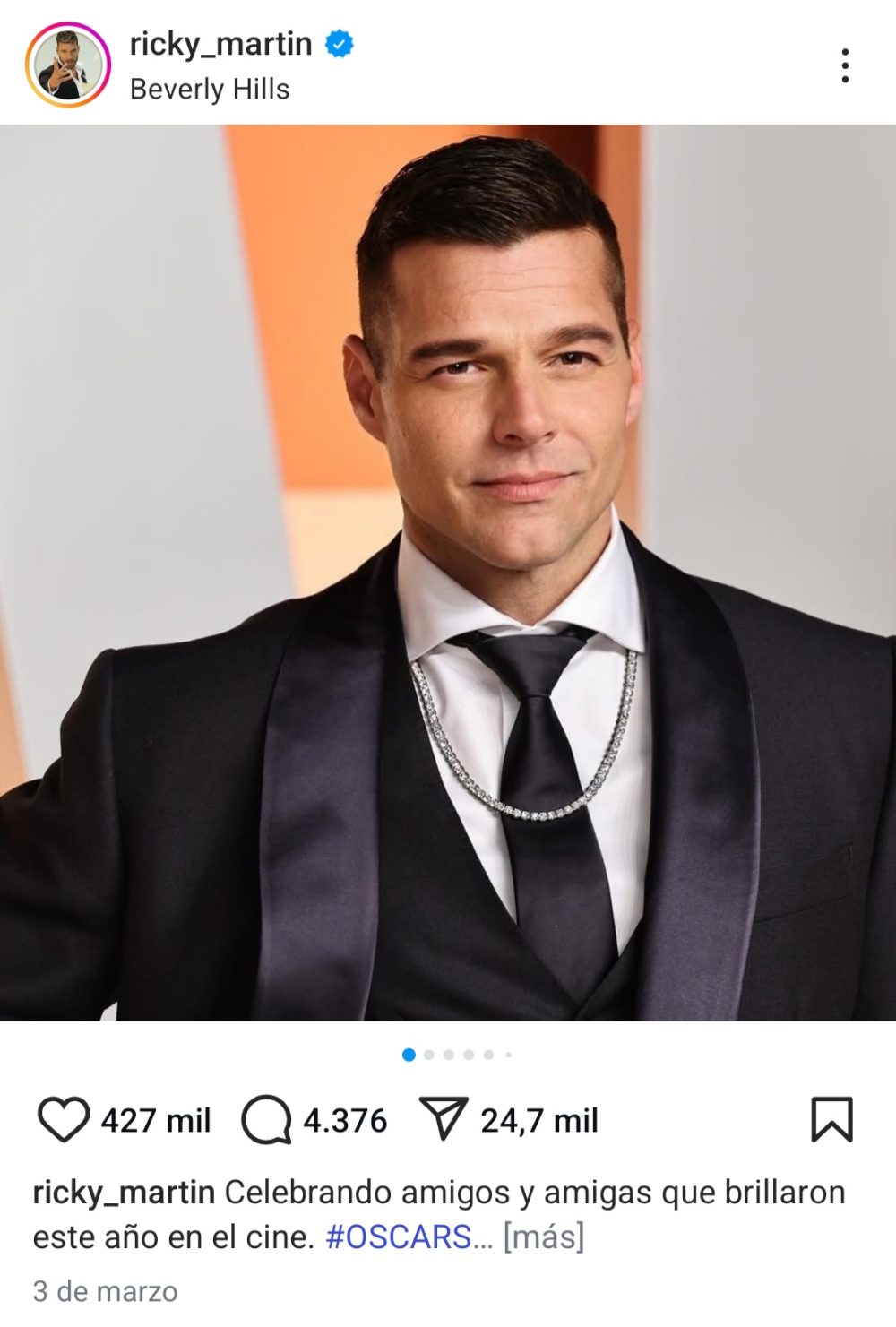 ¿Le ha pedido Ricky Martin a su cirujano que le deje igual que a Pdro Snchz?