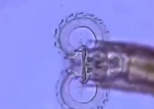 Este microorganismo tiene la boca como una motosierra.