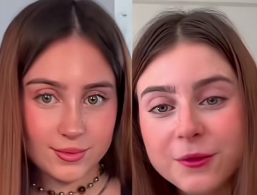 Todo se pega: Roro se ha operado la nariz, igual que su rival en la velada.