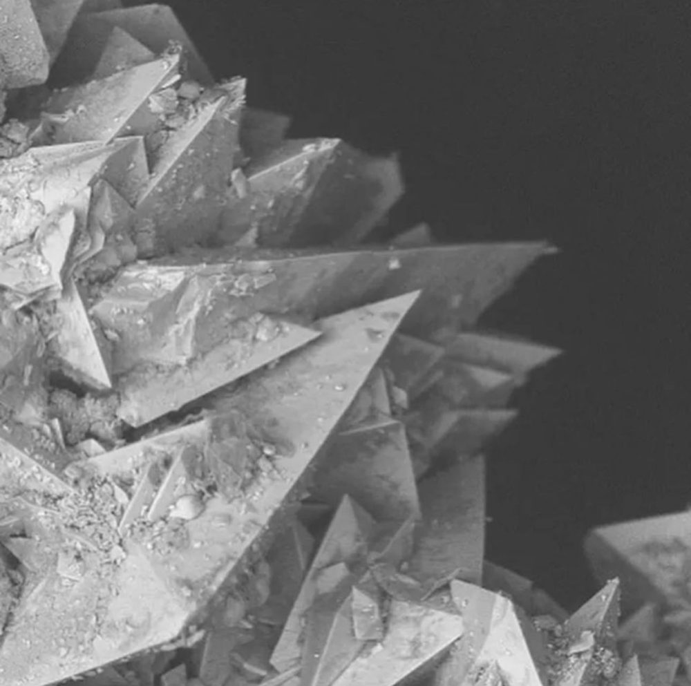 Piedras en el riñón vistas con un microscopio electrónico.