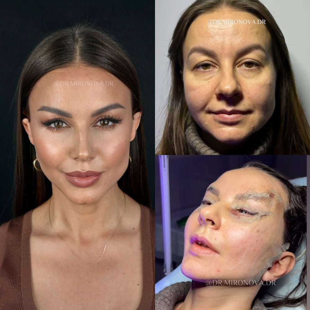 Emosido eñganado otra ves