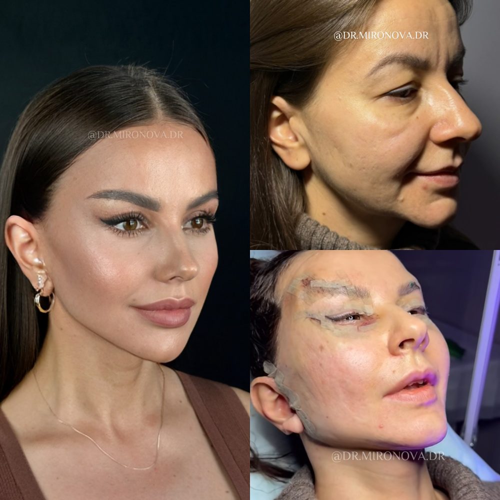 Emosido eñganado otra ves