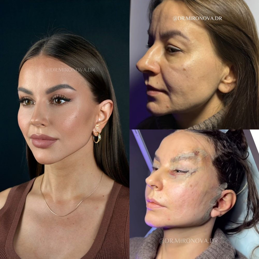 Emosido eñganado otra ves