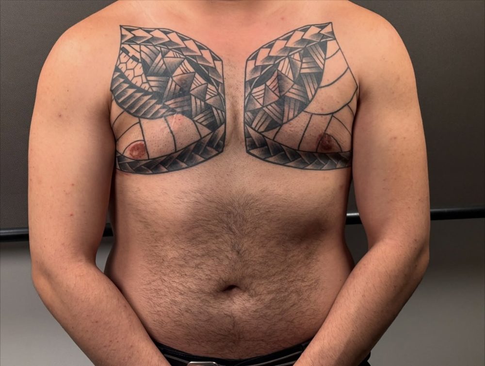 Operación para devolver la dignidad a un paciente mal operado.