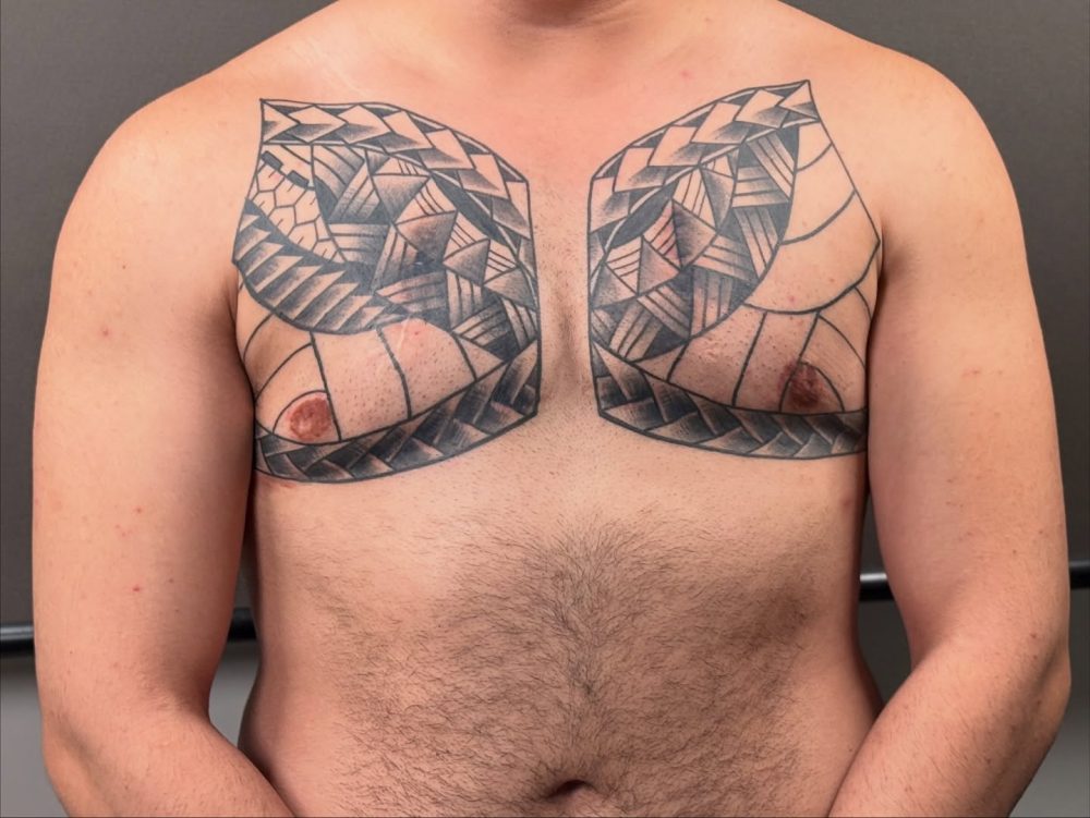 Operación para devolver la dignidad a un paciente mal operado.