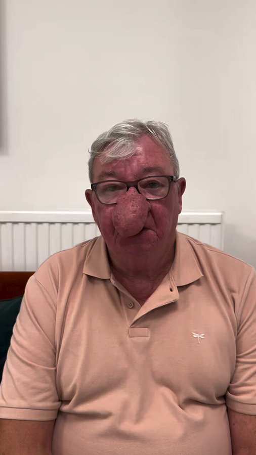 A este hombre le pasa lo contrario que a Lucas.