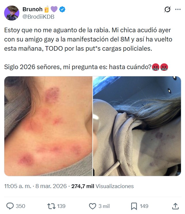 Las típicas lesiones después de acudir al 8M.