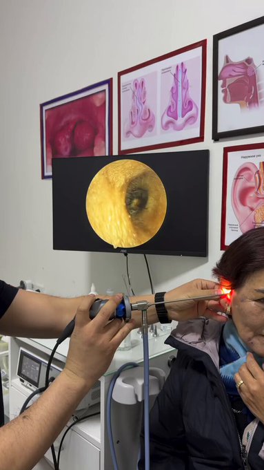 Cuando os pique el oído, recordad este vídeo.