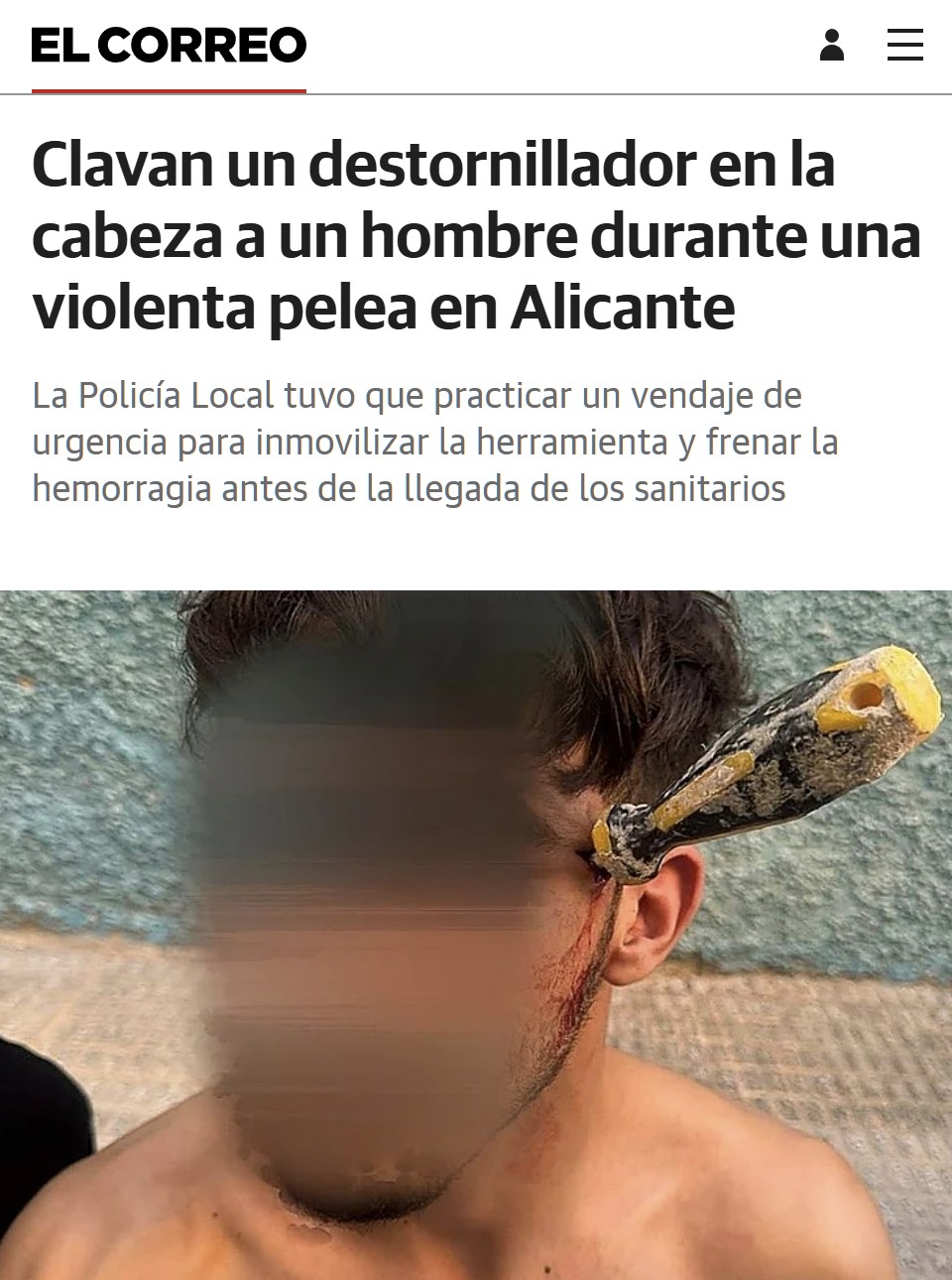 Ahora se puede poner un piercing de lado a lado de la cabeza.
