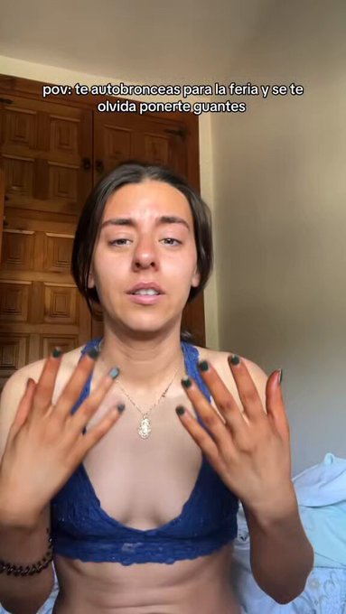 Esta chica quería ponerse morena para la Feria de Sevilla pero olvidó ponerse guantes al autobroncearse.