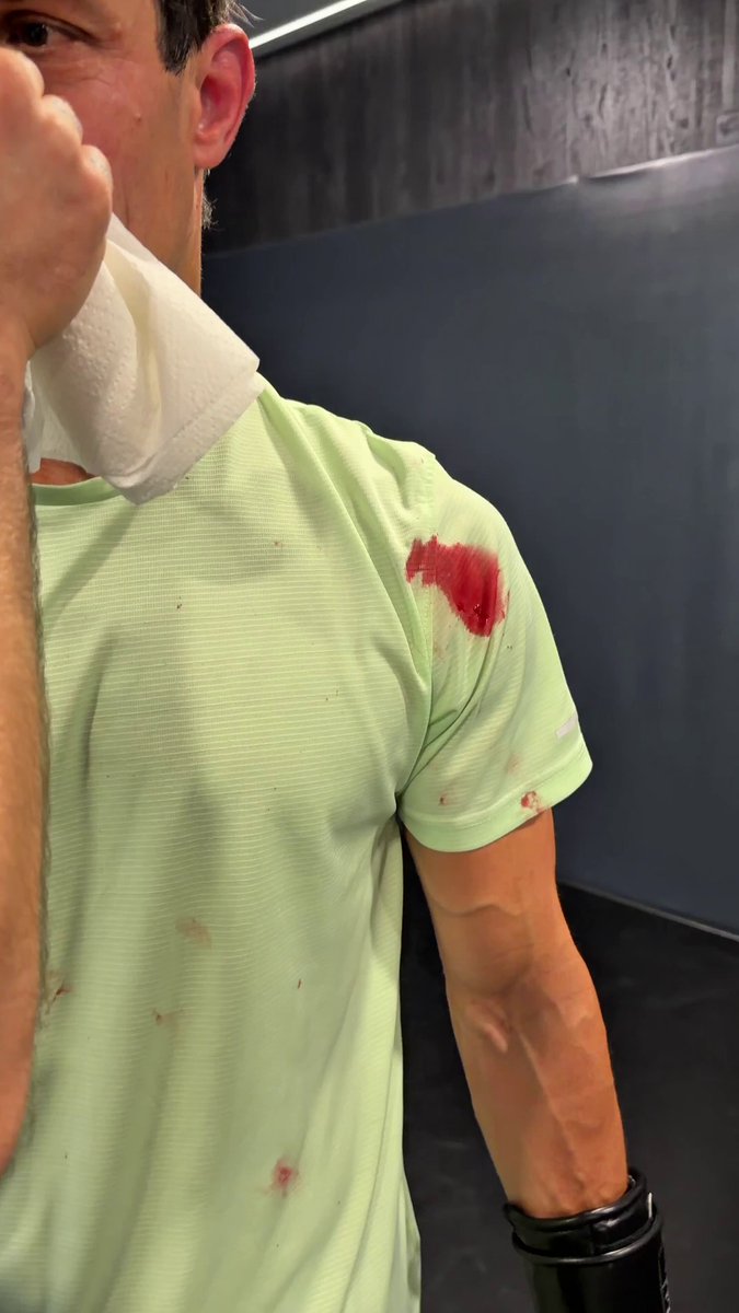 Omar Montes manda al hospital a Edu Aguirre.