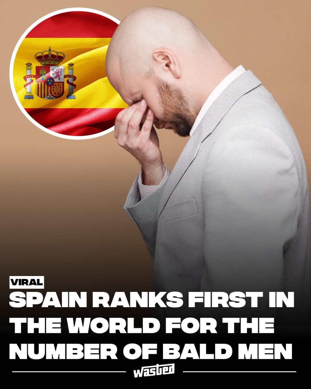 España: líder mundial en calvos.