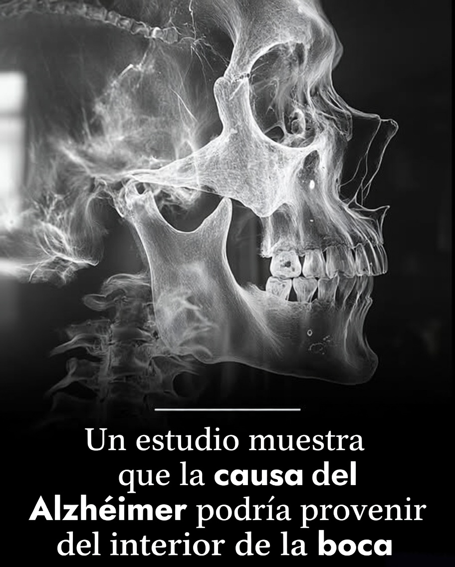 El Alzheimer podría estar relacionado con bacterias de las encías, según una nueva investigación.