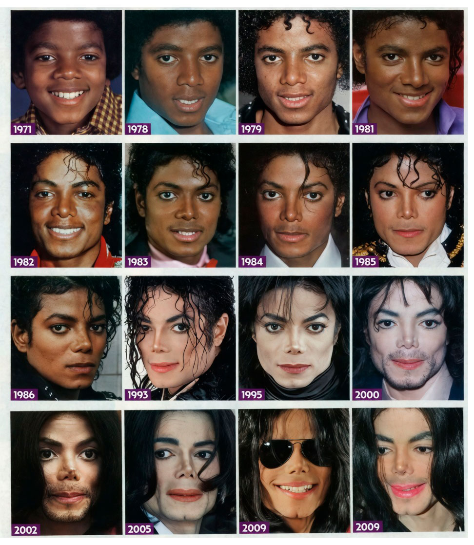 La evolución facial de Michael Jackson.