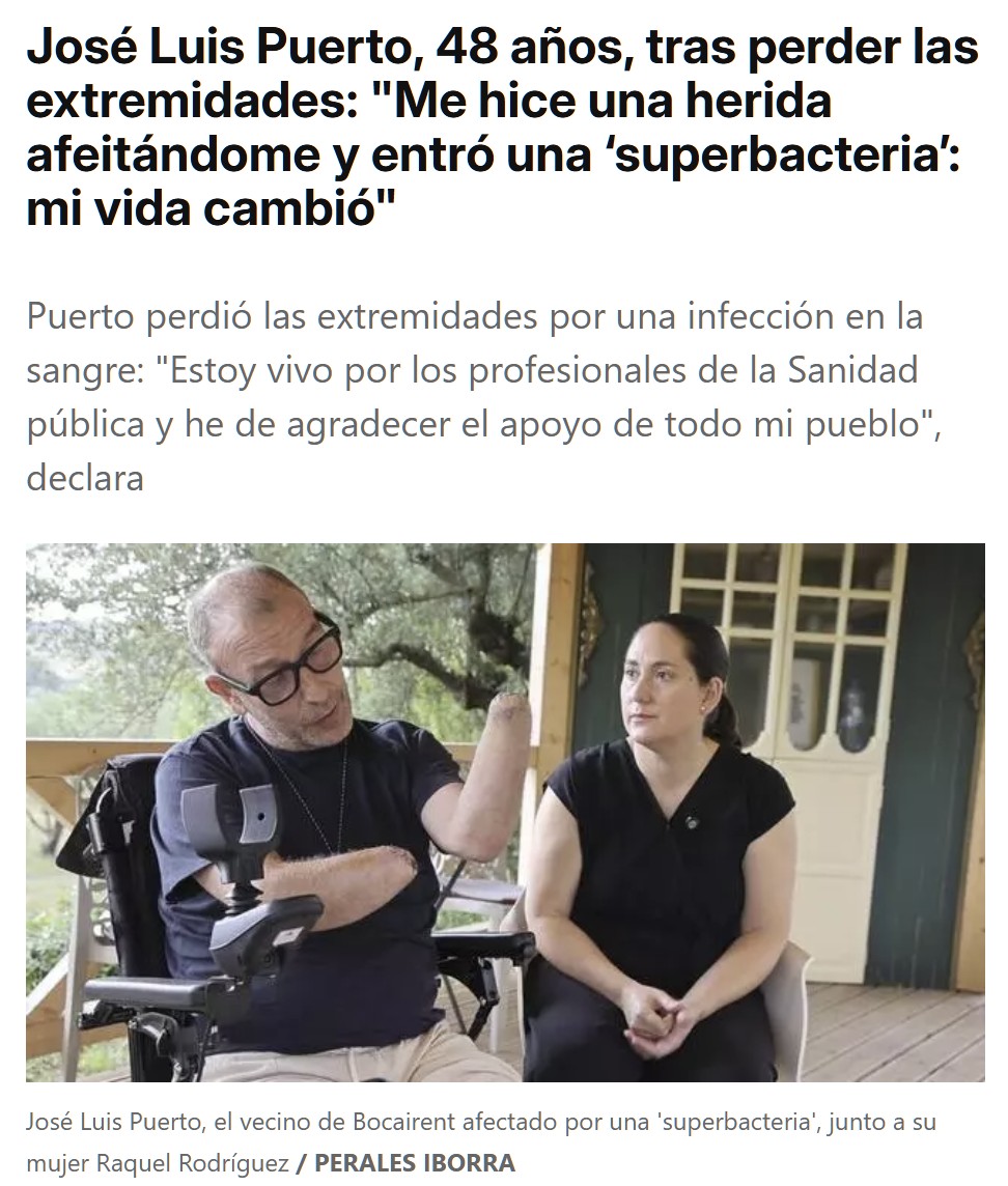 Se afeita los huevos y acaba sin extremidades por una superbacteria