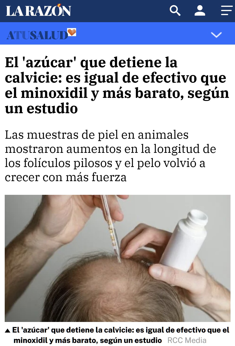 Descubren que el 'azúcar' detiene la calvicie.