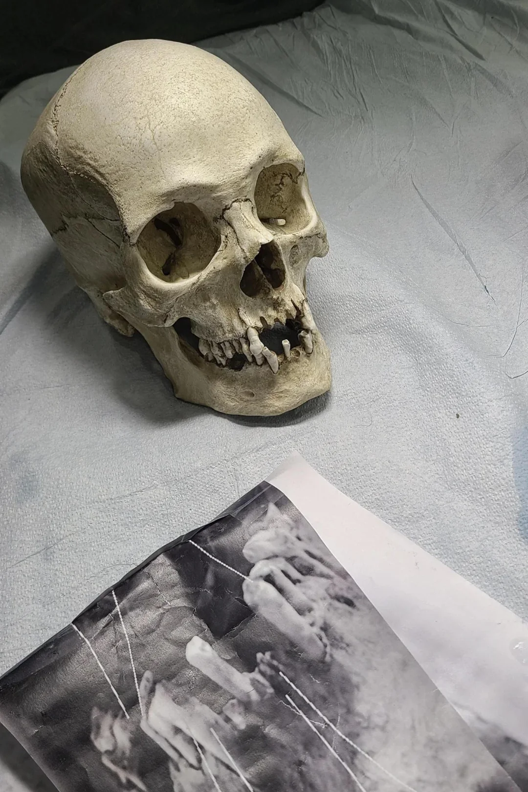 Resultado tras 3 días seguidos tatuándose la pierna.