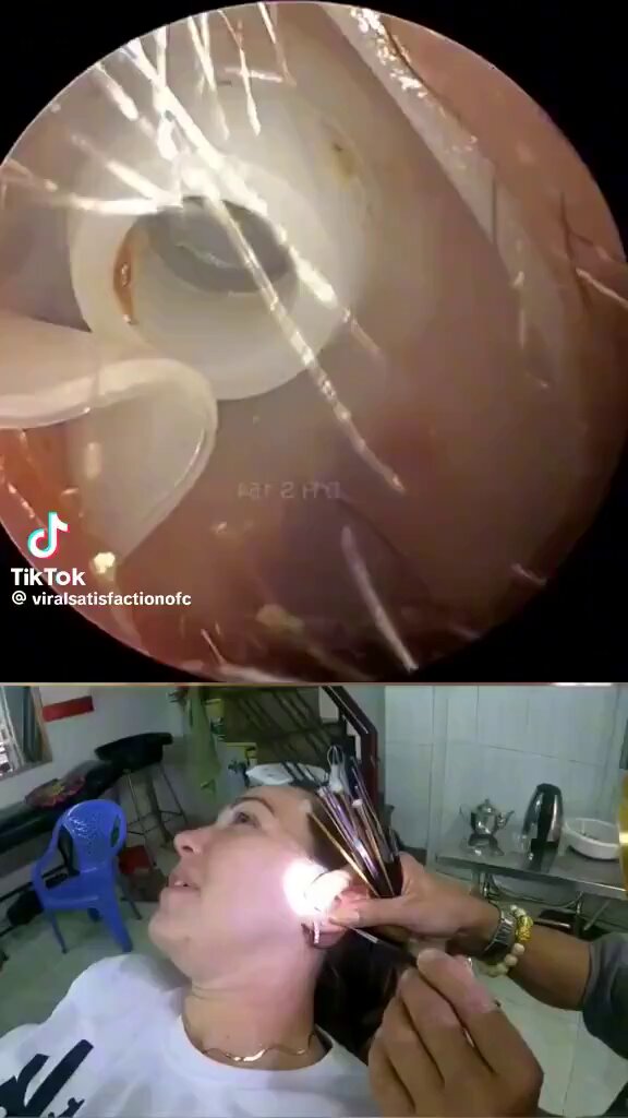 Una mujer empezó a sentir un dolor extraño en el oído y pensó que desaparecería por sí solo, pero, con el paso de los días, el dolor se volvió insoportable, por lo que todo el mundo le aconsejó que fuera al médico.