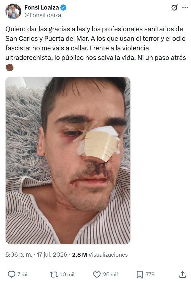A Fonsi Loaiza le han hecho una rinoplastia express.