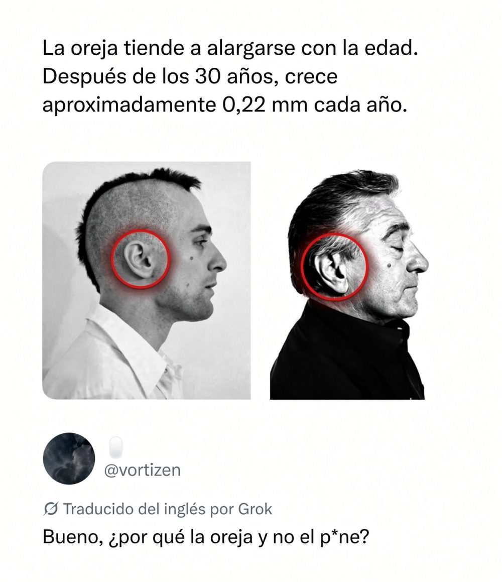 La oreja no deja de crecer.
