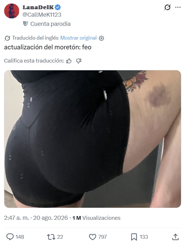 No lo pueden evitar.