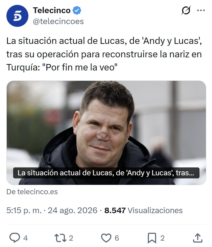 ¿Y la nariz qué tal?