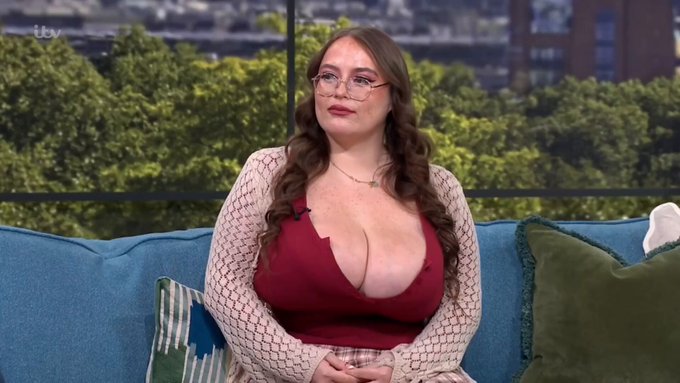 Esta mujer padece una enfermedad rara que hace que sus sеnos nunca dejen de crecer. Ya pesan casi 30 kilos.