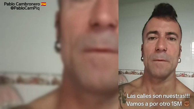 RETRASO MADURATIVO.