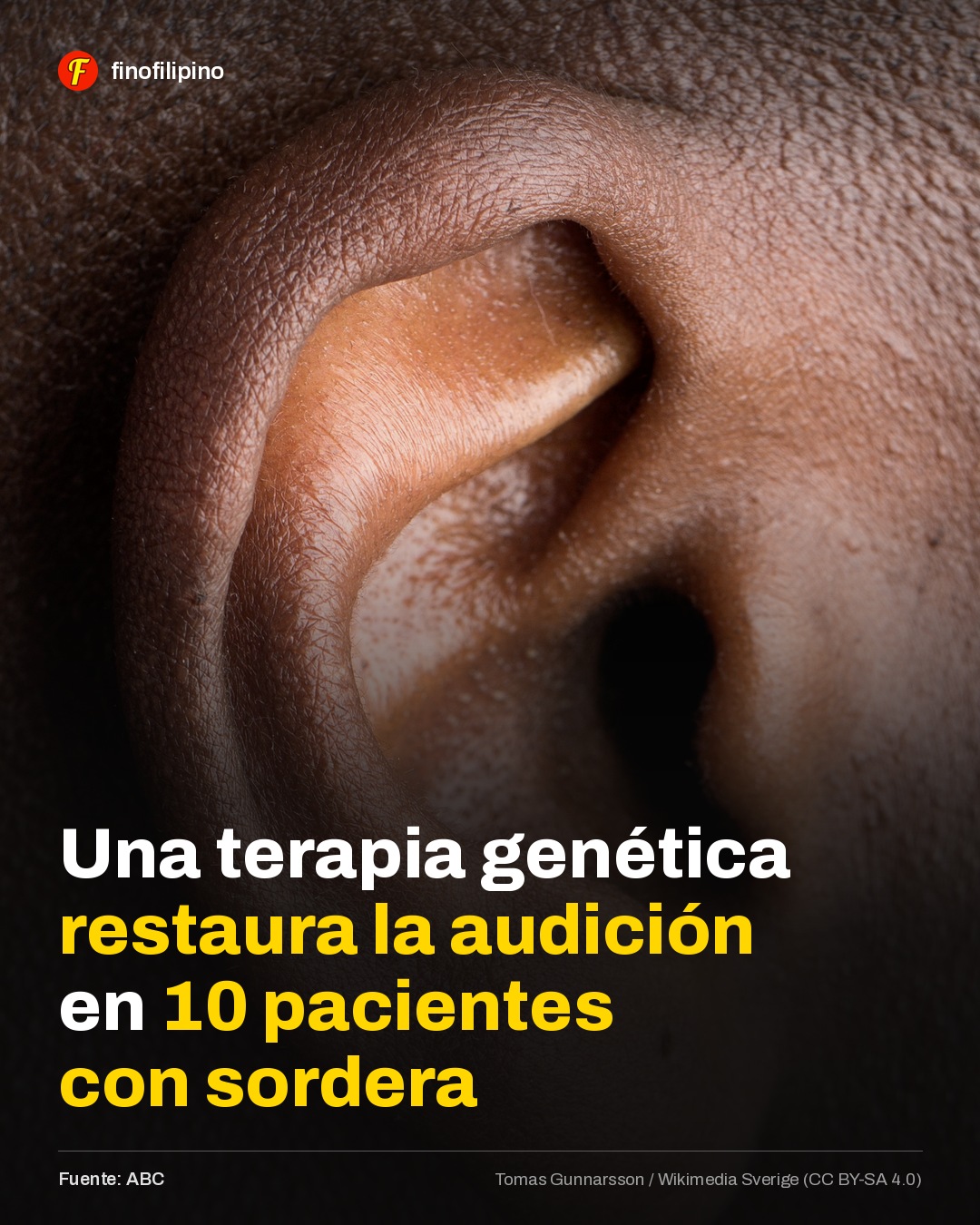 Puede que tengamos la cura definitiva para la sordera.